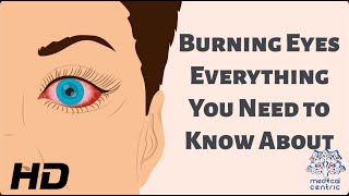 Burning Eyes Everything You Need to Know [upl. by Mehitable]