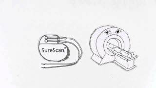 Medtronic SureScan® MRI [upl. by Simaj243]