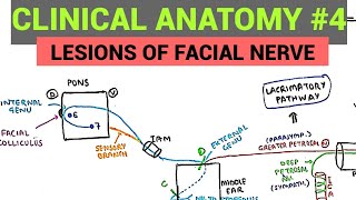 Facial Nerve Anatomy  3  Lesions of Facial Nerve [upl. by Anyd]