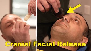 How To Perform Cranial Facial Release Technique On A Patient [upl. by Ayhdnas]