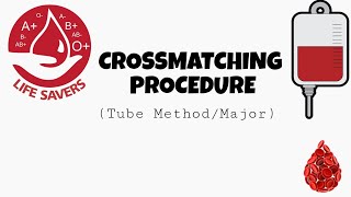 Crossmatching Procedure  Tube methodMajor [upl. by Kristoffer]