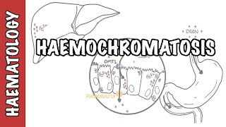 Haemochromatosis Iron Overload  iron physiology causes and pathophysiology [upl. by Roban472]