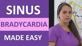 Sinus Bradycardia ECGEKG Interpretation Causes Treatment Nursing NCLEX Review Cardiac [upl. by Hsetirp]