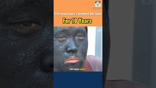 This man hasn’t washed his face for 10 years [upl. by Wauters]