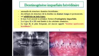 Cours Odontologie Conservatrice et Endodontie Deuxième Année Médecine Dentaire Partie 2 [upl. by Abrams1]