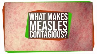 Why Is The Measles Virus So Contagious [upl. by Leftwich481]