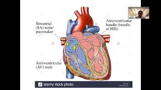 Cardiología 19 Bradiarritmias [upl. by Acemaj]