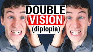 What Causes DOUBLE VISION Diplopia  5 Common Causes for Diplopia  Doctor Eye Health [upl. by Chaker]