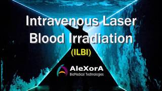 Intravenous Laser Blood Irradiation [upl. by Aicenad]