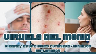 VIRUELA DEL MONO 🐵 Erupciones cutáneas fiebre ganglios ALERTA EPIDEMIOLÓGICA 📢 [upl. by Puklich]