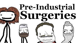 PreIndustrial Surgeries [upl. by Dnalevelc986]