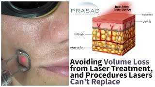 Avoiding Facial Volume Loss from Laser Radiofrequency Treatments and Procedures They Cant Replace [upl. by Akamahs]