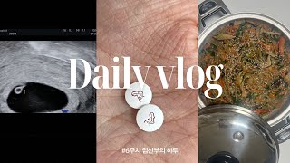 6주차 임산부의 VLOG [upl. by Uyekawa]