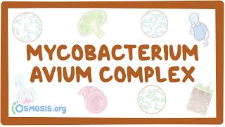 Mycobacterium avium complex  causes symptoms diagnosis treatment pathology [upl. by Sethrida946]