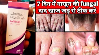 Lulifresh Lotion for fungal infections  दाद खाज खुजली का एक सटीक इलाज Medicineking [upl. by Ahseka]