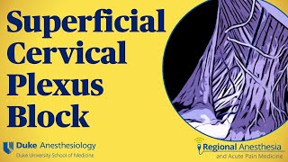 Superficial cervical plexus block [upl. by Rellim]