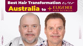 GOAT Hair Transformation Journey From Australia to Eugenix [upl. by Agon983]