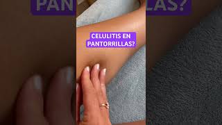 CELULITIS EN PANTORRILLAS masajeparacelulitis [upl. by Beeson]