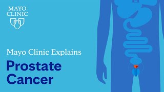 Mayo Clinic Explains Prostate Cancer [upl. by Arocal331]