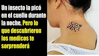 UN INSECTO LE PICO EL CUELLO DURANTE LA NOCHE PERO LO QUE DESCUBRIERON LOS MÉDICOS SORPRENDIÓ [upl. by Ednargel749]