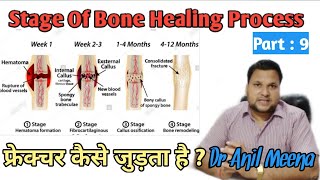 Bone fractures healing process  Fracture bone healing time  Fracture bone Repair  in Hindi [upl. by Prober571]