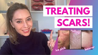 How To Treat Scars Flat Depressed Raised and Keloids  Dr Shereene Idriss [upl. by Cryan]