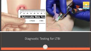 The Role of Interferon Gamma Release Assay IGRA Testing in the TB Testing Program [upl. by Burget346]