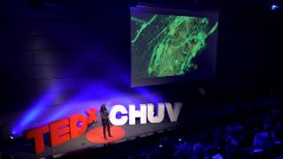 These cells in your brain might heal you some day  Jocelyne Bloch  TEDxCHUV [upl. by Cita]