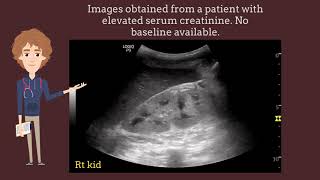 Kidney Function Tests and Interpretation of Results [upl. by Becka591]