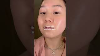 POV your skin is congested kbeauty [upl. by Anafetse]