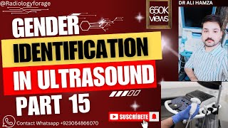 Gender Identification Male or Female in ultrasound Part 15 ultrasound medical technology [upl. by Ardath]