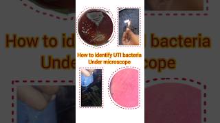 identify the bacteria microscope shorts producer bacteria viral shortsfeed [upl. by Nims653]