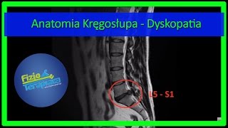 Anatomia Kręgosłupa  Dyskopatia 4 FizjoTerapia HD [upl. by Enimajneb]