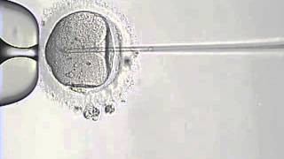 Intracytoplasmic Sperm Injection Procedure ICSI [upl. by Urbai966]