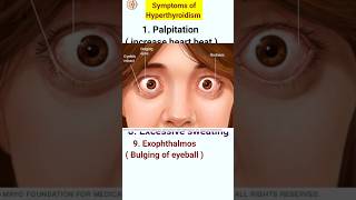 Symptoms of hyperthyroidism  hyperthyroidism ke lakshan  shorts shortfeeds [upl. by Nnywg]