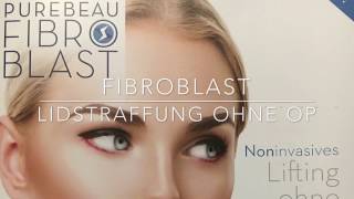 Fibroblast  Lidstraffung ohne OP  Plasma Pen [upl. by Justina]