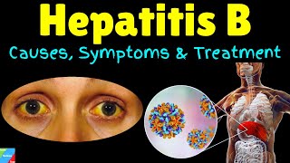 Hepatitis B – Symptoms Causes Risk Factors Pathophysiology Diagnosis Treatment [upl. by Namus]