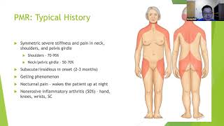 Polymyalgia Rheumatica PMR and Giant Cell Arteritis GCA [upl. by Lallage667]