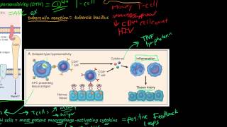 81P DelayedType Hypersensitivity TCellMediated Type IV Hypersensitivity [upl. by Agnola]