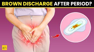 How To Stop Brown Discharge After Period  Causes amp Natural Remedies [upl. by Bartolome]