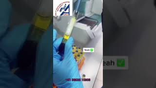 How to use a micropipette in the lab pathology dmlt upsmfac sample micropipette [upl. by Arlyne]