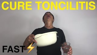 How to cure tonsillitis naturally [upl. by Yllier914]