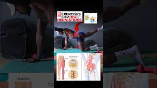 9 Effective herniated disc exercises and stretches herniateddisc herniarepair stretches [upl. by Eiclek676]