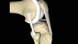 Lateral Collateral Ligament motion in flexionextension [upl. by Elery]