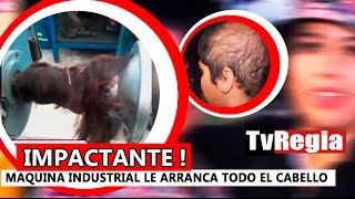 Impactante video chica pierde toda su cabellera en maquina industrial [upl. by Uba]