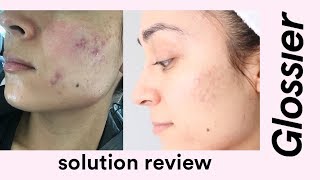 Glossier Solution Review [upl. by Suzie]