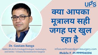 Hypospadias in hindi  क्या आपका मूत्र पथ सही जगह पर है  Dr Gautam Banga [upl. by Lluj759]