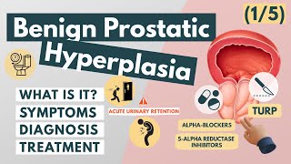 What is Benign Prostatic Hyperplasia  Overview for Med Students  Urology [upl. by Jacobo]