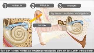 Wie das Gehör und das Hören mit einem CochleaImplantat funktioniert [upl. by Buehrer]