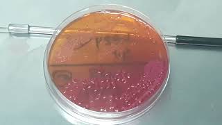 Stenotrophomonas maltophilia Gram staining Culture Characteristics and Wet mount Microscopy [upl. by Lody322]